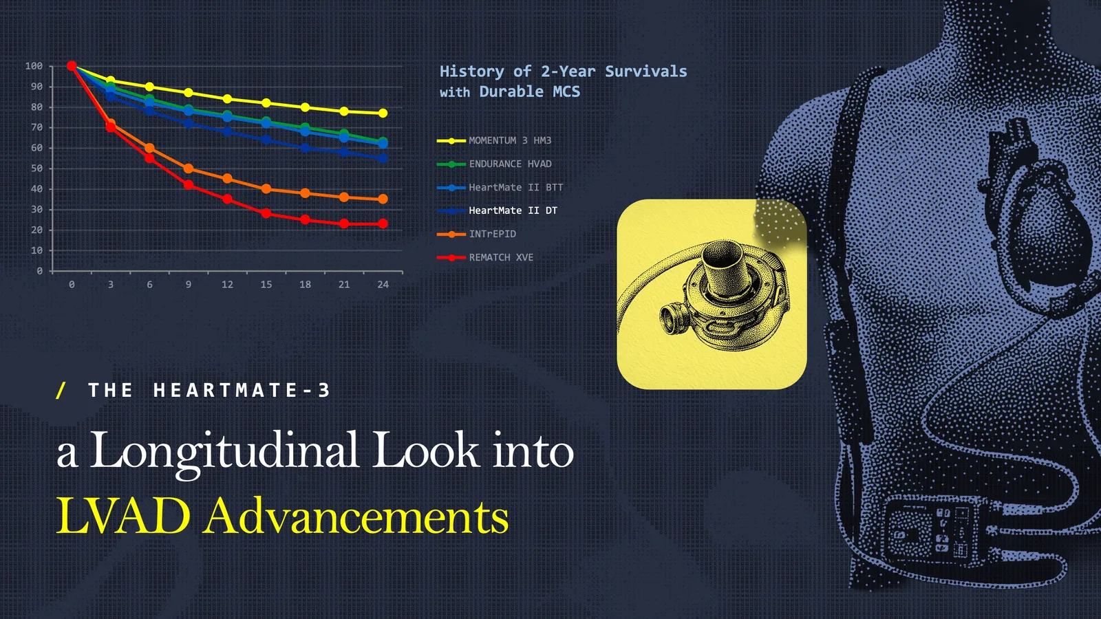 HeartMate 3 — a longitudinal look into LVAD advancements